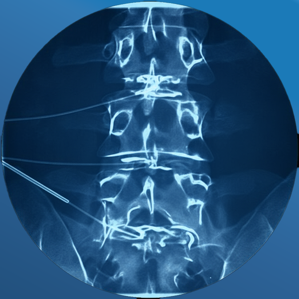 Discography / Discogram - Abovepain